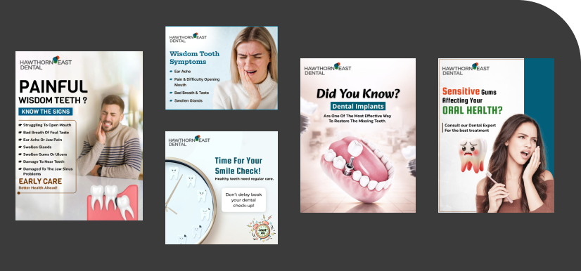 Dental implants
